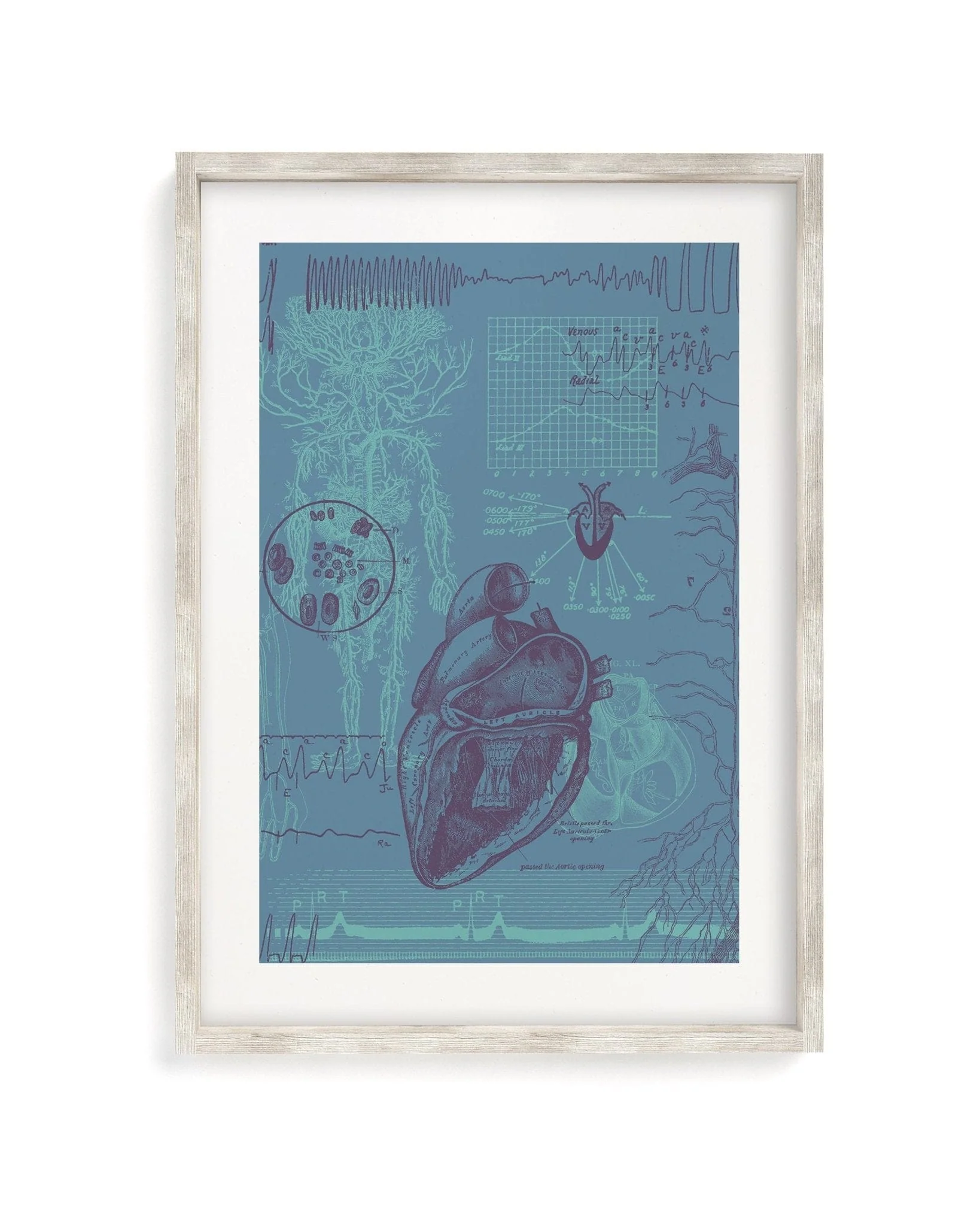 Cardiology Scientific Illustration Museum Print - Image 4