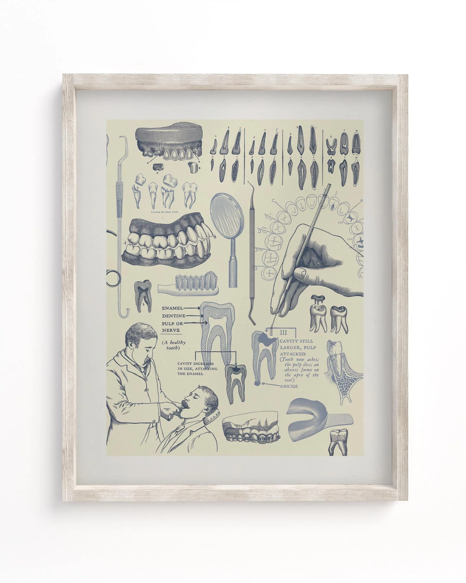 Dentistry Medical Illustration Museum Print