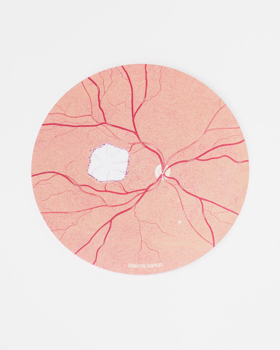 Retina Photo Sticker