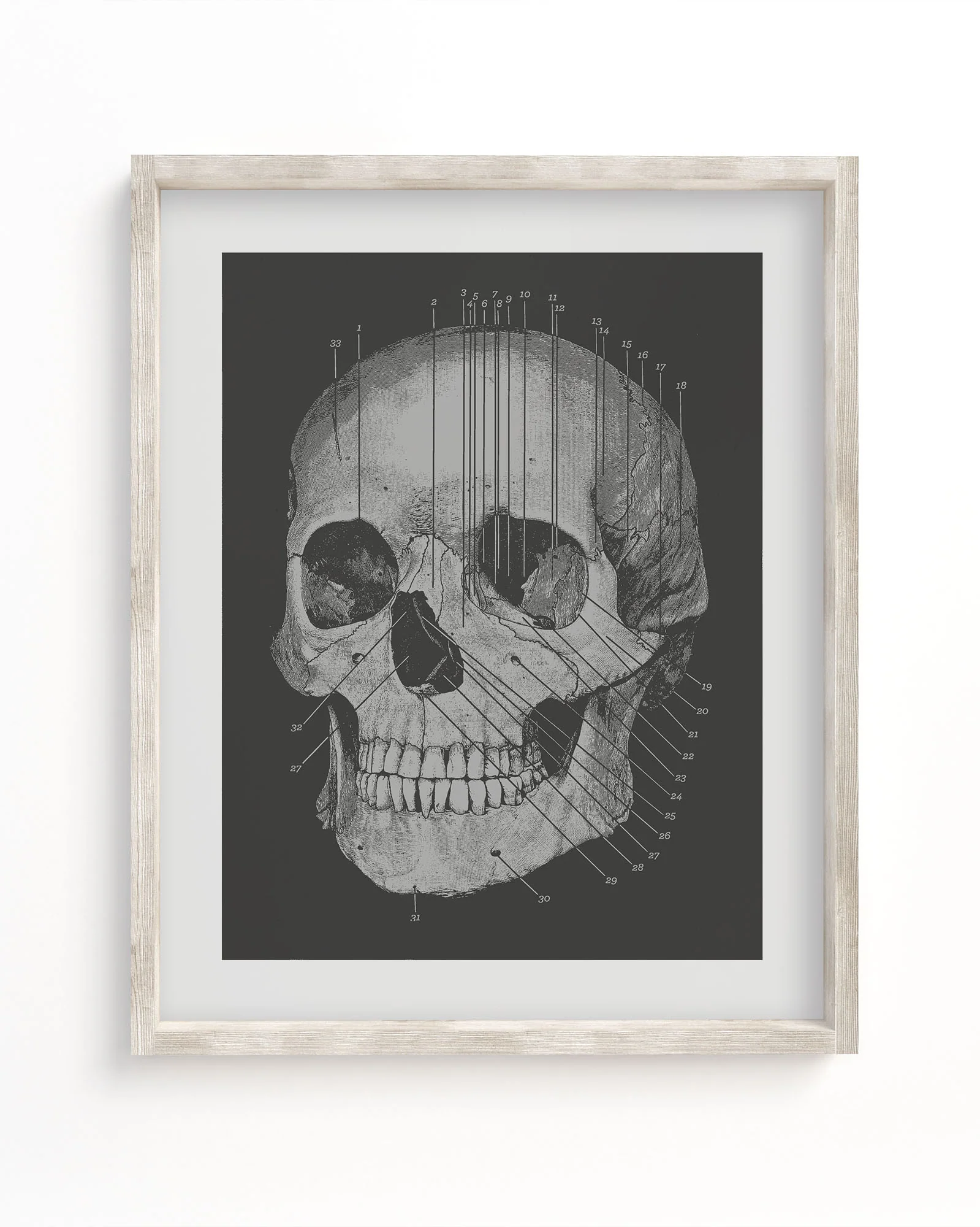 Skull Medical Illustration Museum Print