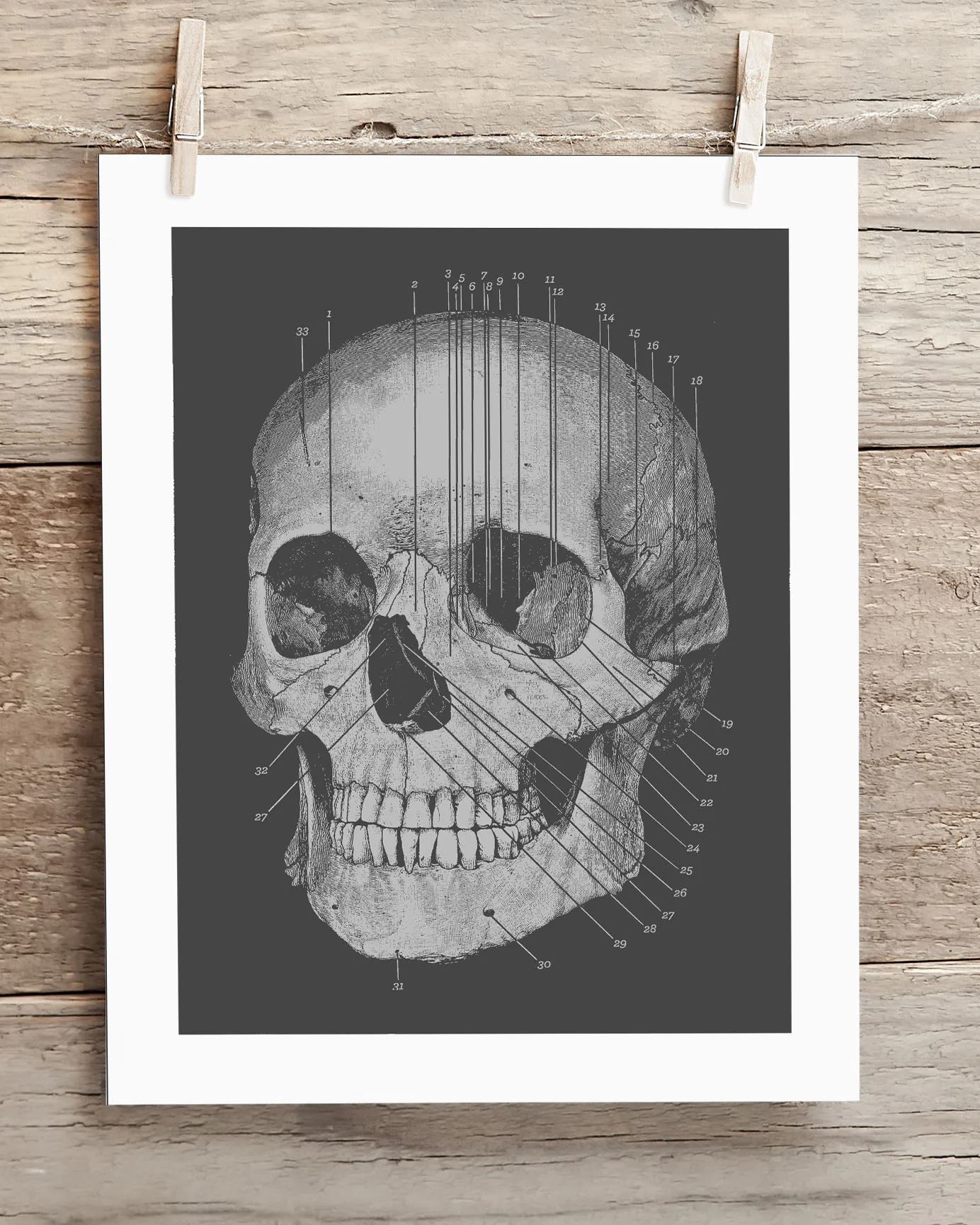 Skull Medical Illustration Museum Print - Image 2